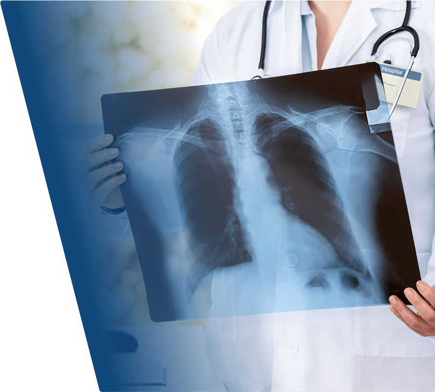Doctor wearing a white coat and stethoscope holding a chest X-ray film showing the lungs and ribcage. The X-ray is held up for viewing, with a hospital ID badge clipped to the coat.