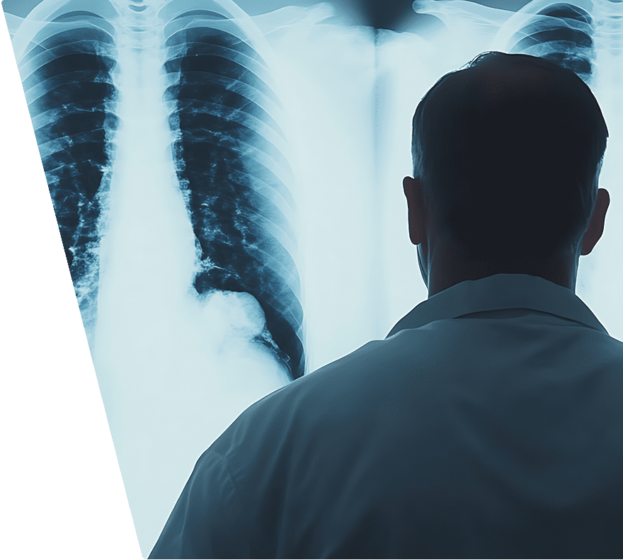 A person in a white coat is viewing a chest X-ray showing the ribcage, spine, and lungs. The X-ray reveals detailed bone structures and lung fields.
